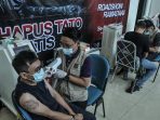 Hapus Tato